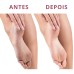 PEDICURE ELETRICO REMOVEDOR NEW217